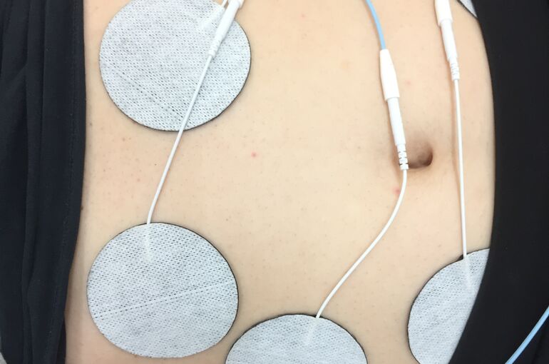 Emsエルビオでおなか周りのシェイプアップ フリーパスキャンペン実施中 スタッフブログ 大宮のくしひき整骨院が定期的に更新する記事をぜひご覧ください
